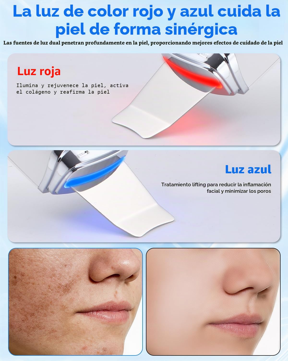 Peeling Ultrasonico Facial, Viene con 4 Modos Faciales e Intensidad Ajustable, Paleta Ultrasonica Facial Profesional, Luz Roja y Azul, Pantalla LED y Función de Apagado Automático