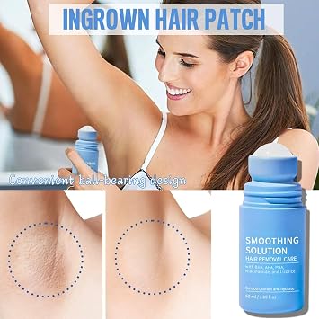 Razor Bump Smoothing Solution Ingrown Hair with BHA AHA - High Roller Ingrown Tonic for Underarms Abdomen, Roller Ball Applicator for Tend Skin, Hydrating Care for Underarm/Face/Neck/Leg