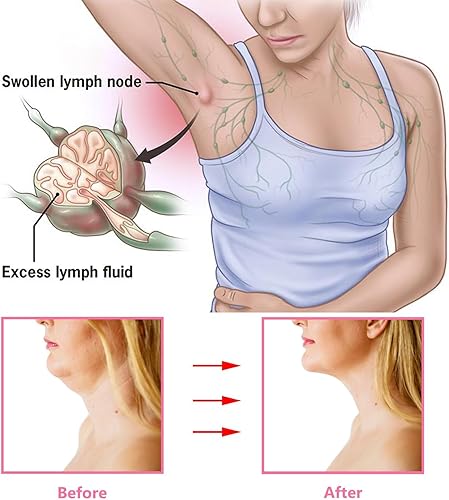 Miniatura 5 de 2 pares de aretes de aro de actividad linfática, aretes de drenaje linfático, aretes de germanio de magnetoterapia, aretes de aro grandes con