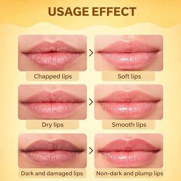 6PCS Bees Lips Balm Honey Lip Balm Set,Mini Lip Balms for Dry Cracked Lips,Moisturising Lip Care Set with Vitamin E,3 Fruity Flavours Natural Formula,Hydrating Tinted Lip Care,Reduce Lip Lines