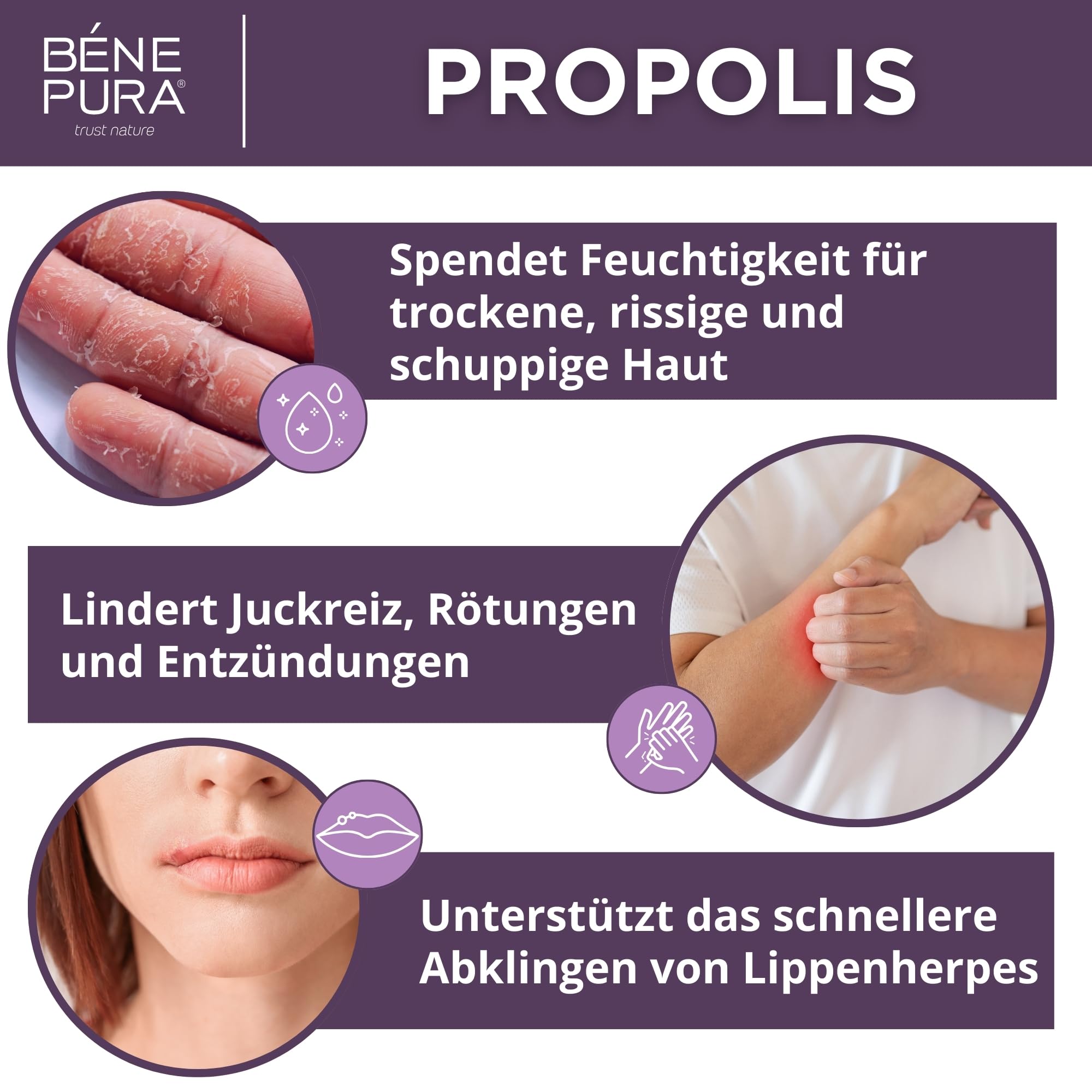 BenePura Propolis Salbe, Natürliche 30% Propolis Salbe für Juckende, Trockene und Rissige Haut, 40 ml (3er Pack)