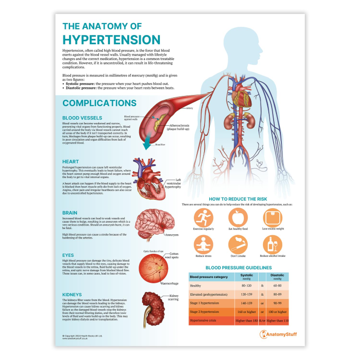 Anatomy Stuff Hypertension Anatomystuff The Anatomy Of Poster/Chart 45X60cm, 18X24 Inches, Understanding Blood Pressure Patient Education Guide