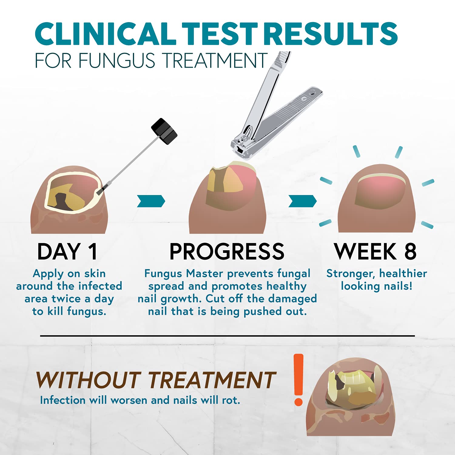 Buy Ebanel Foot Fungus Treatment Extra Strength Athletes Foot Cream