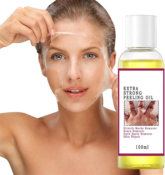 Extra Strength Yellow Peeling Oil, Knuckles Skin Whitening, Yellow Peeling Oil for Dark Skin Exfoliating, Exfoliating Whitening Softening Callus Removal, for Body All Skin Type (1)