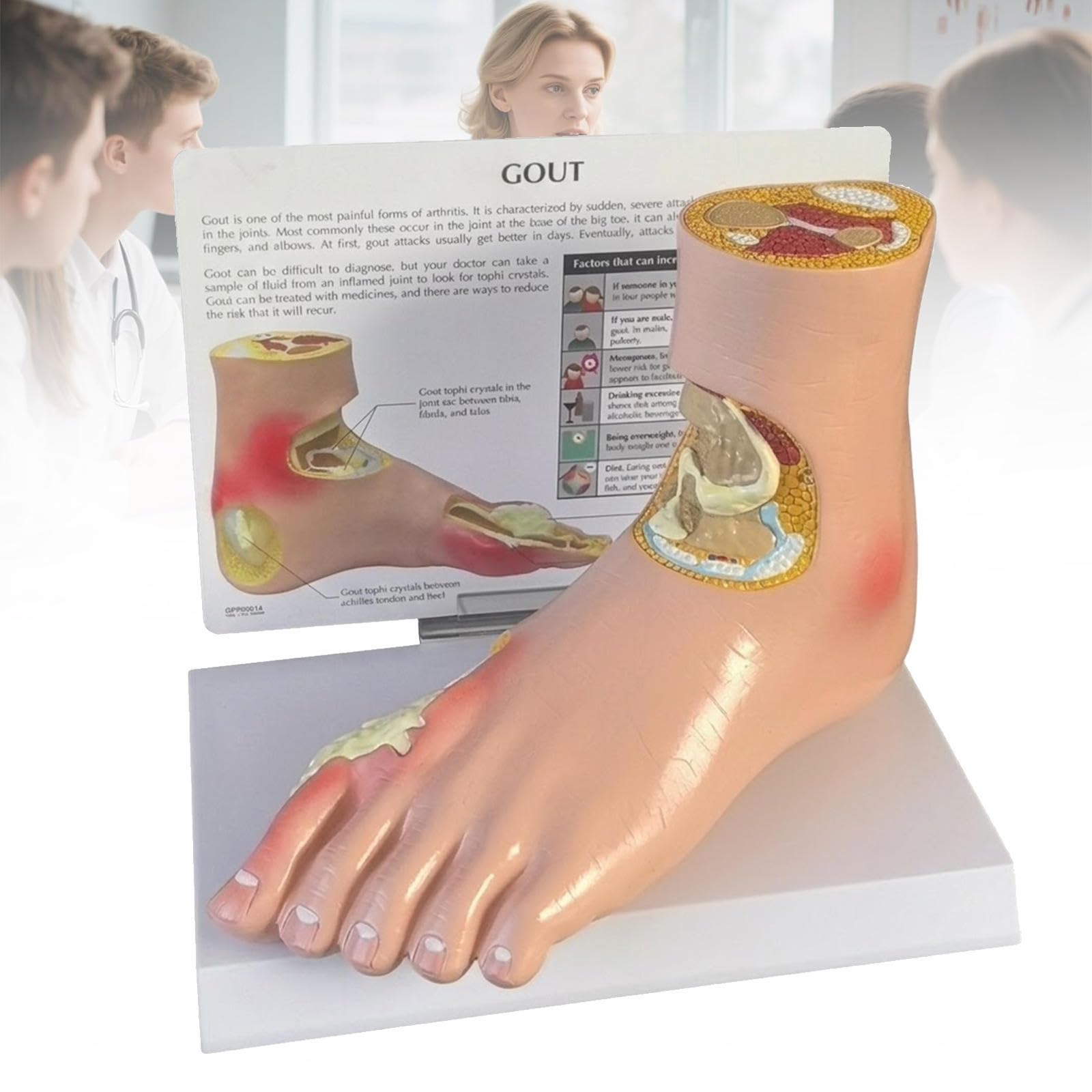 KJZQXYX Life-Size Human Diabetic Foot Model for Gout, Hypertension & Pathology Education - Anatomical Demonstration Tool for Medical Training