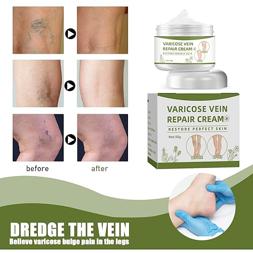 Miniatura 5 de Crema de venas varicosas crema reparadora de venas arañas mejora la circulación sanguínea crema de tratamiento de venas varicosas para piernas dolor