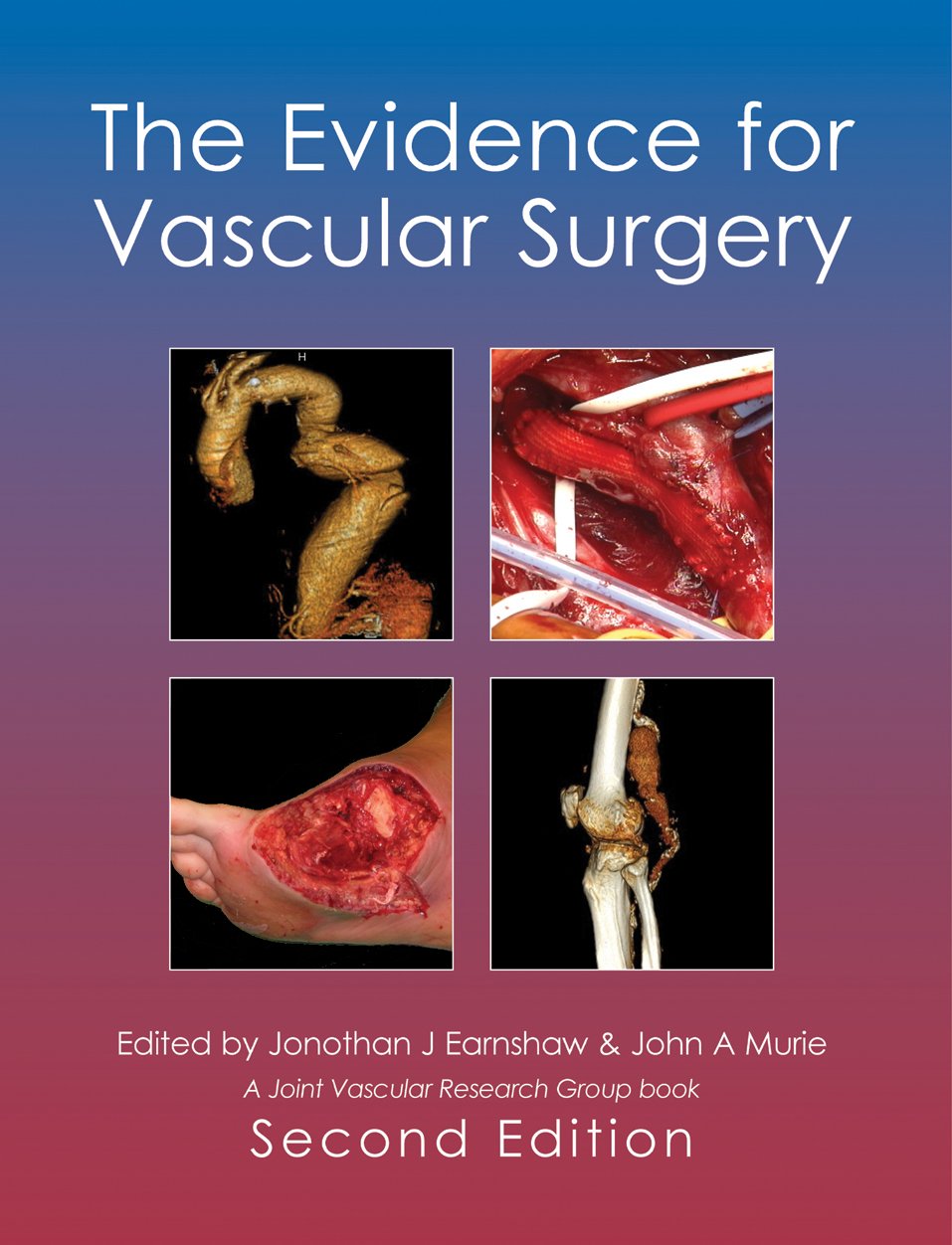 The Evidence for Vascular Surgery; second edition