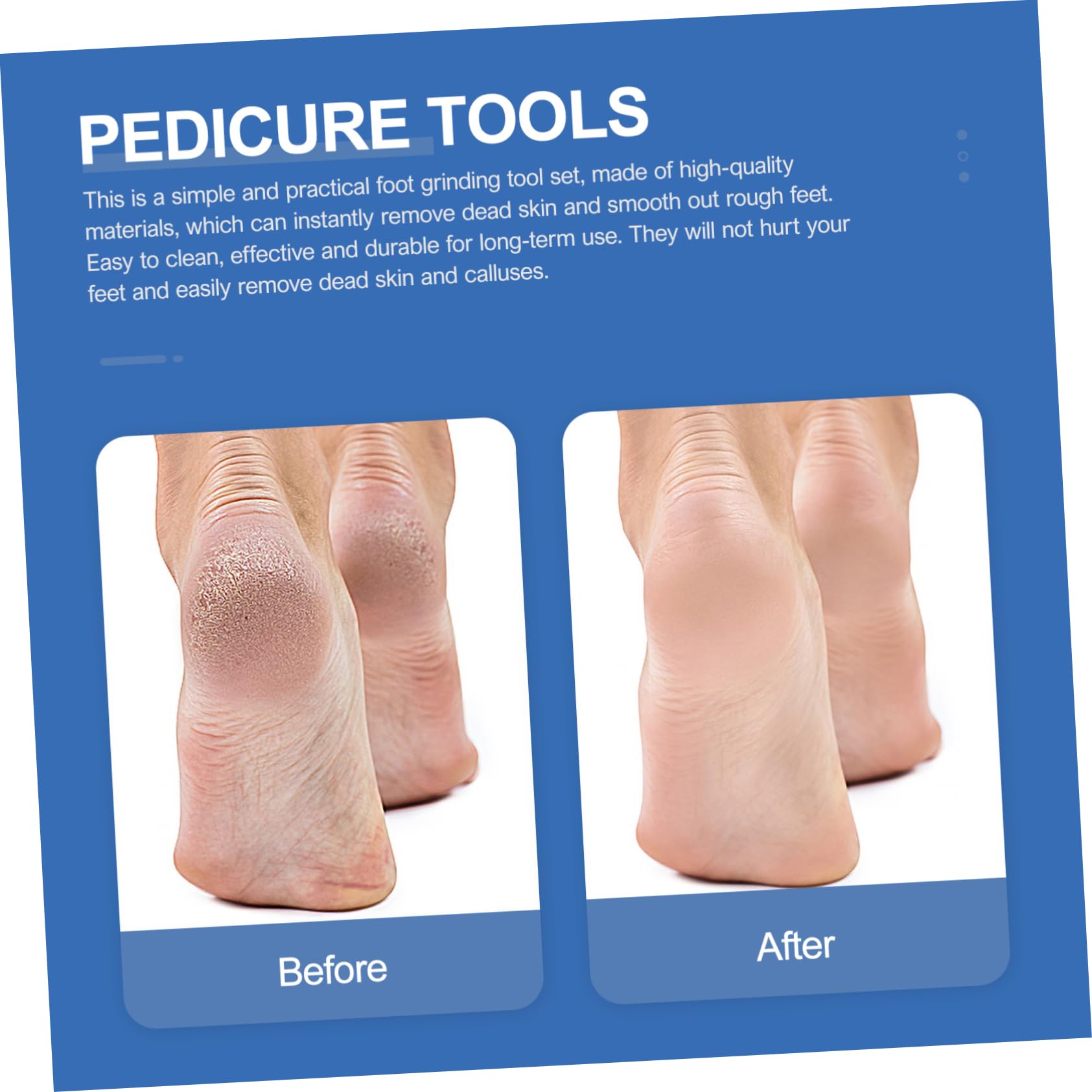 WOFASHPURET Foot Tool Kit 7pc Set Manicure Knife Dead Skin Remover Perfect for Home Professional Use