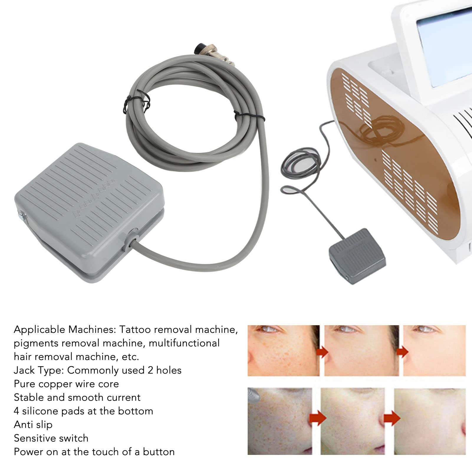 Pedal de Tatuaje, Interruptor de Pie de Tatuaje Láser de 2 Orificios, Cable de 78,7 Pulgadas, Interruptor de Pedal Antideslizante para Máquina de Depilación, Máquina de Depilación