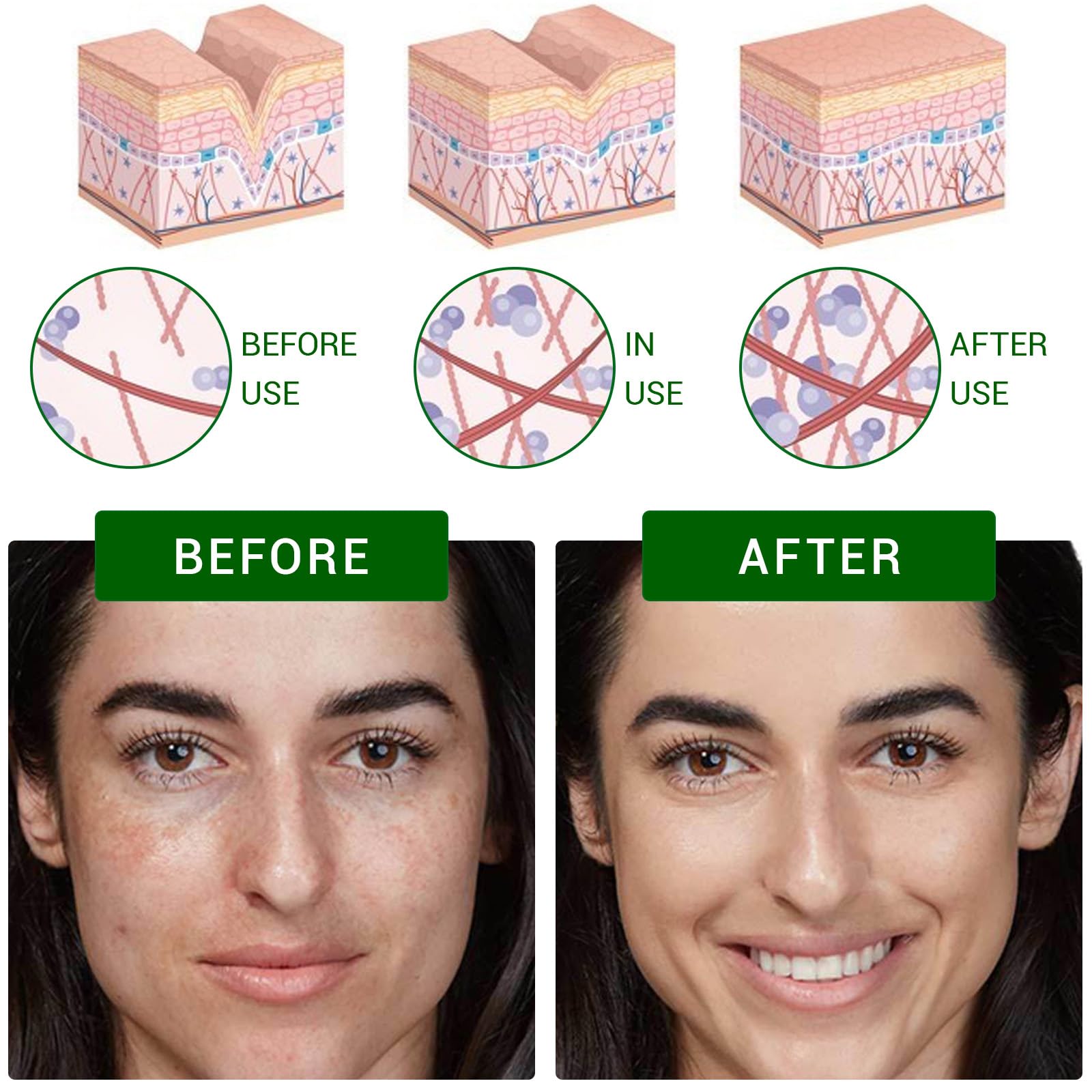 Dark Spot Correcting Glow Serum, Dark Spot Remover for Face Pore Refining Fades Acne Marks Pits, 25 ml (Pack of 2) - Image 3