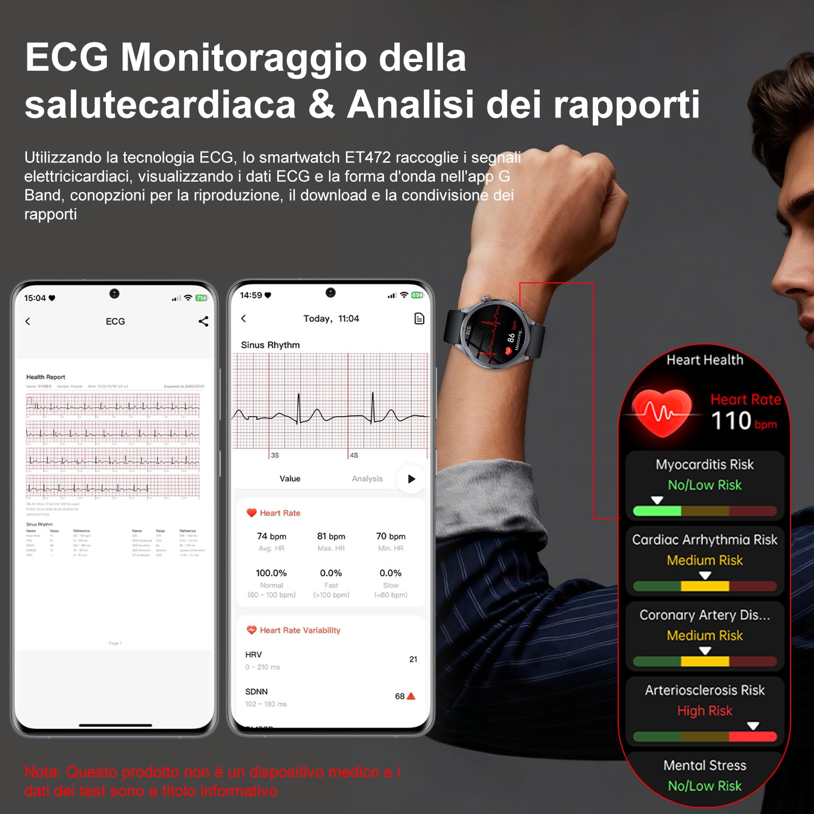 YUPENG AI Smartwatch Uomo ChatGPT ECG/𝐆li𝐜e𝐦ia/HRV/Lipidi/Acido Urico/BMI, 1.53" Orologio Fitness Chiamate/Torcia, 24H Pressione Sanguigna/Sonno/Temperatura/Cardiofrequenzimetro/SOS, Android iOS