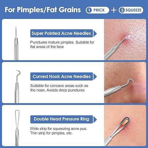 Miniatura 4 de Herramienta removedor de puntos negros, kit de eliminación de acné para manchas, estallido de puntos blancos, 7 piezas de eliminación de espinillas