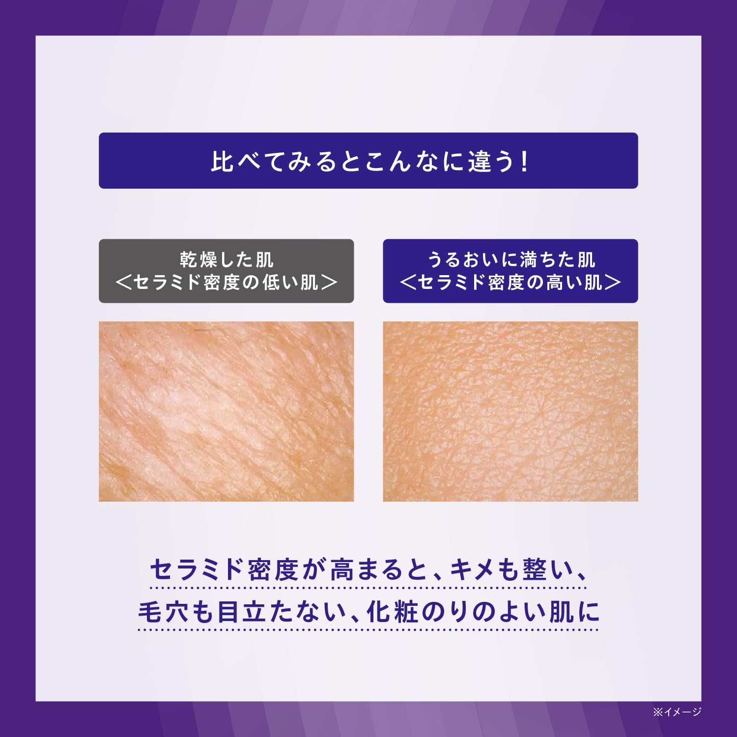 Amazon | ONE BY KOSE(ワンバイコーセー) 【医薬部外品】 薬用導入美容