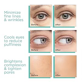 MontBeauty Ice Globes for Face, Freezer Safe and Highly Effective Facial Globes for Daily Beauty Routines, Face Roller to Tighten Skin, Reduce Puffiness, Enhance Circulation and Complexion (Blue)