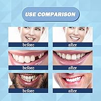 Vista 7 de Kit de reparación de dientes de 1.0 fl oz, kit de reemplazo de dientes temporales – Perlas moldeables de ajuste térmico para rellenar dientes