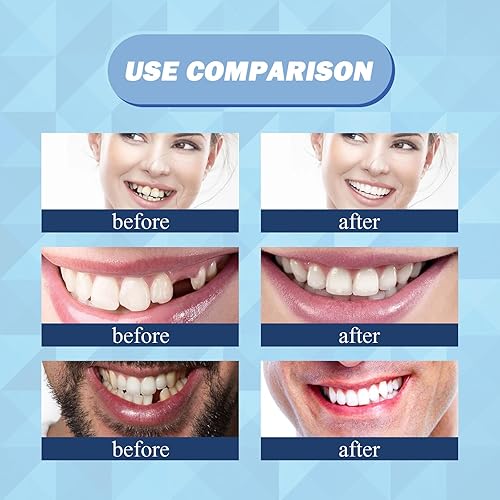Miniatura 7 de Kit de reparación de dientes de 1.0 fl oz, kit de reemplazo de dientes temporales – Perlas moldeables de ajuste térmico para rellenar dientes