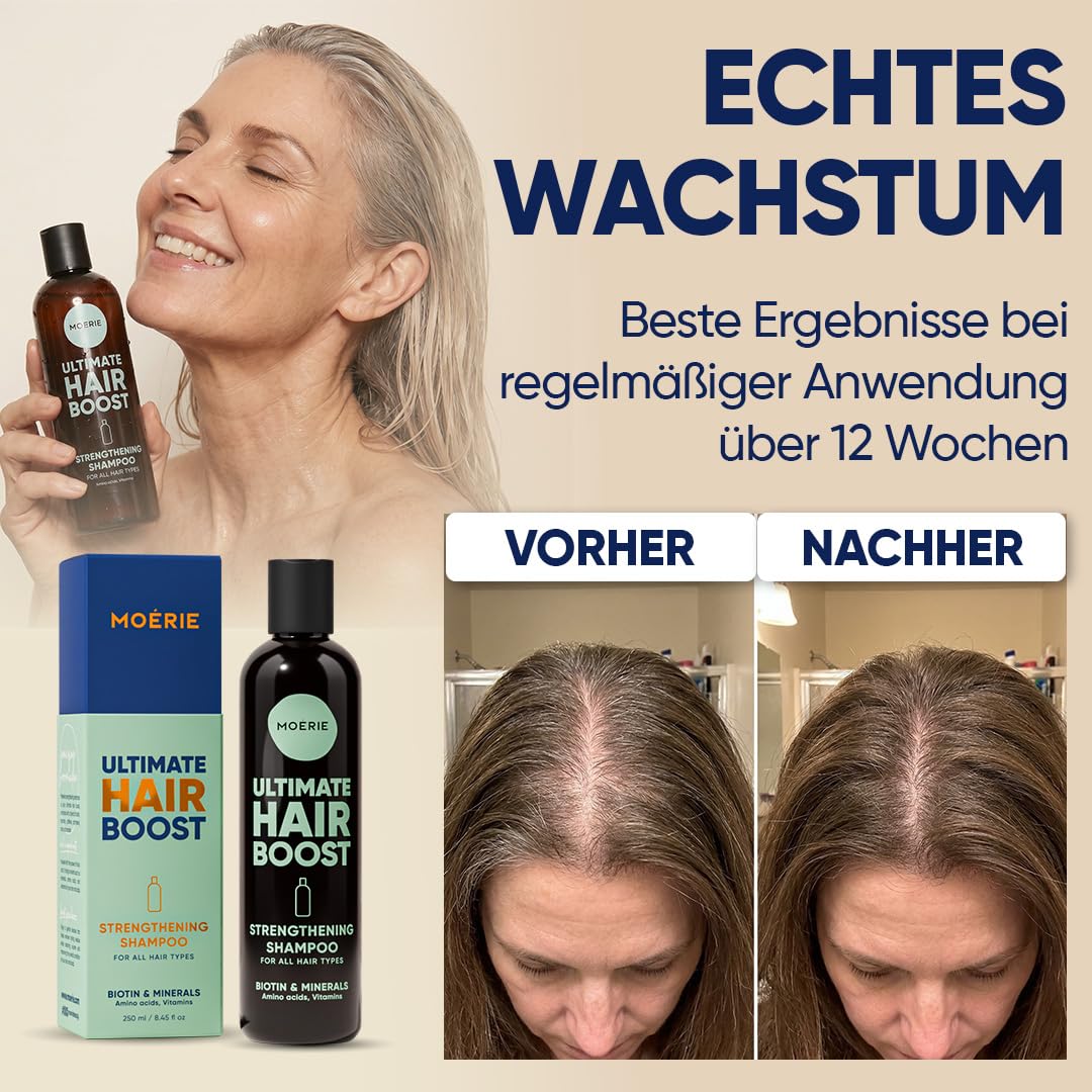 Haarwachstum Shampoo gegen Haarausfall – Biotin und Koffein Haarwuchs Shampoo für Frauen und Männer – haarwachstum beschleunigen, reduziert Haarverlust