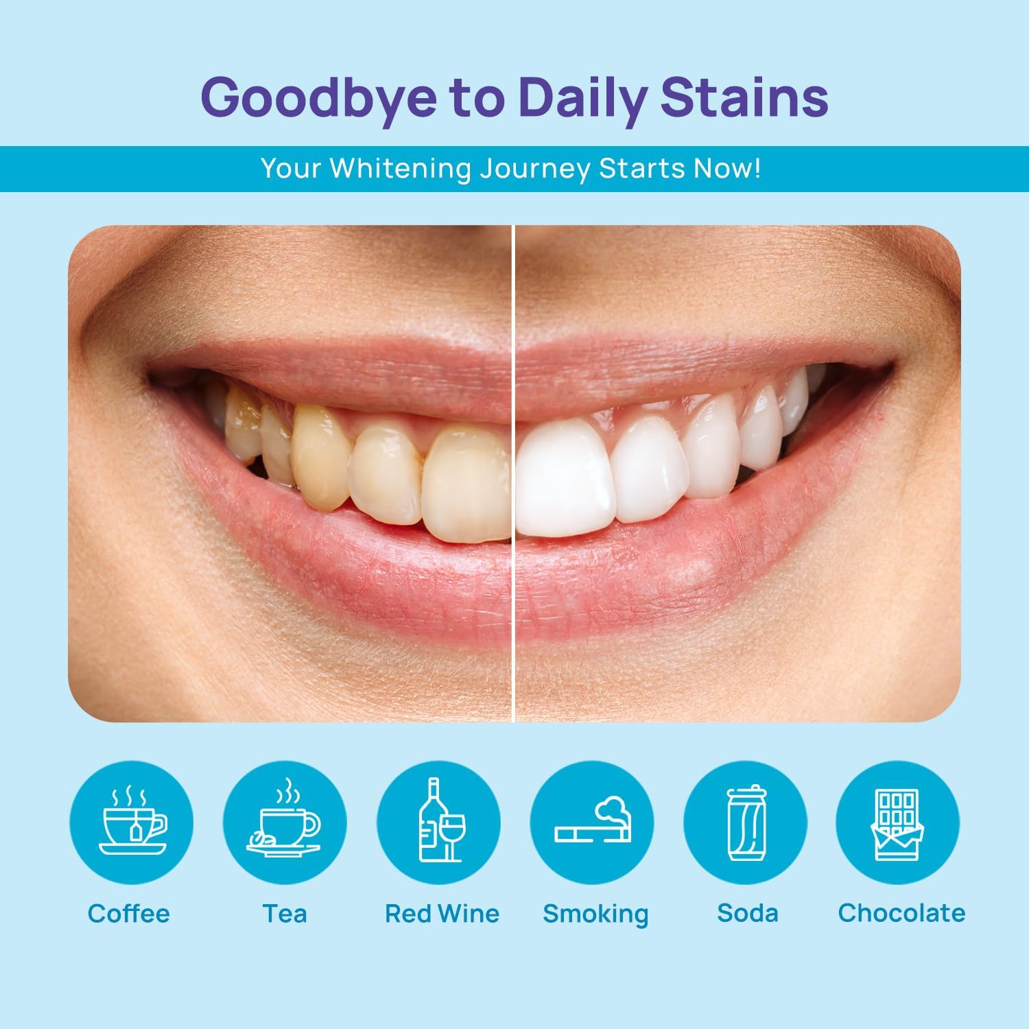 Whitebite Pro Advanced Whitening Kit & Whitening Pens Bundle