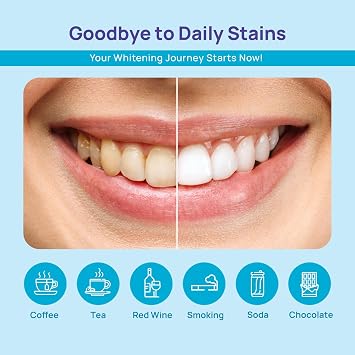 WhiteBite Pro Teeth Whitening Pens for Sensitive Teeth (4 Pens) 35% Carbamide Peroxide Gel, Desensitizing Gel Fast Whitening, Enamel-Safe, Travel-Friendly