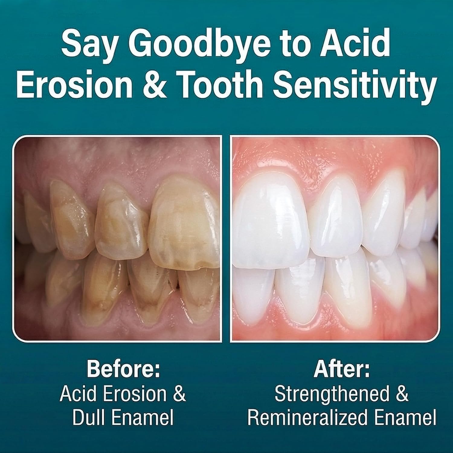 Remineralizing Gum, Hydroxyapatite Chewing Gum for Tooth Remineralization, 120 Sugar-Free Gum Tablets, Enamel Repair, Fresh Breath & Gum Health Support, Natural Mint Formula