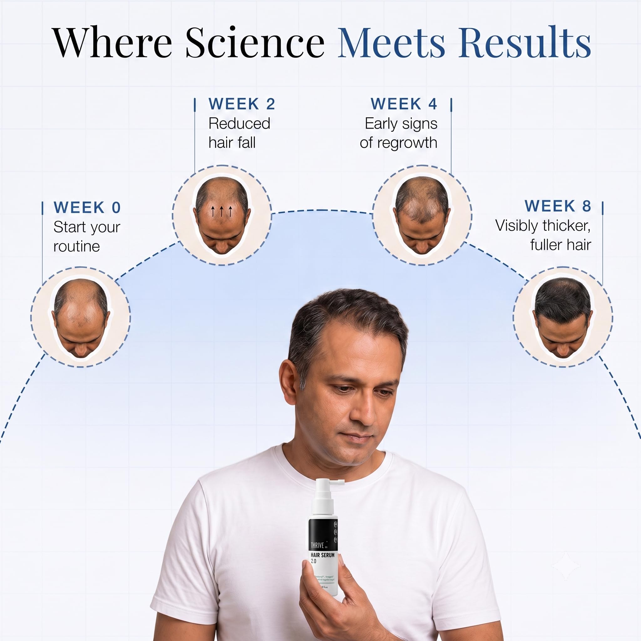 ThriveCo Hair Growth Serum For Scalp, Spray 50ml | Advanced Patent Filed Clinically Proven Scalp Treatment for Hair Fall Control & Regrowth | British Medical Publication | Redensyl, Anagain, Regendil®, Rosemary Oil | Lightweight, Non-Sticky Solution | Men & Women 4
