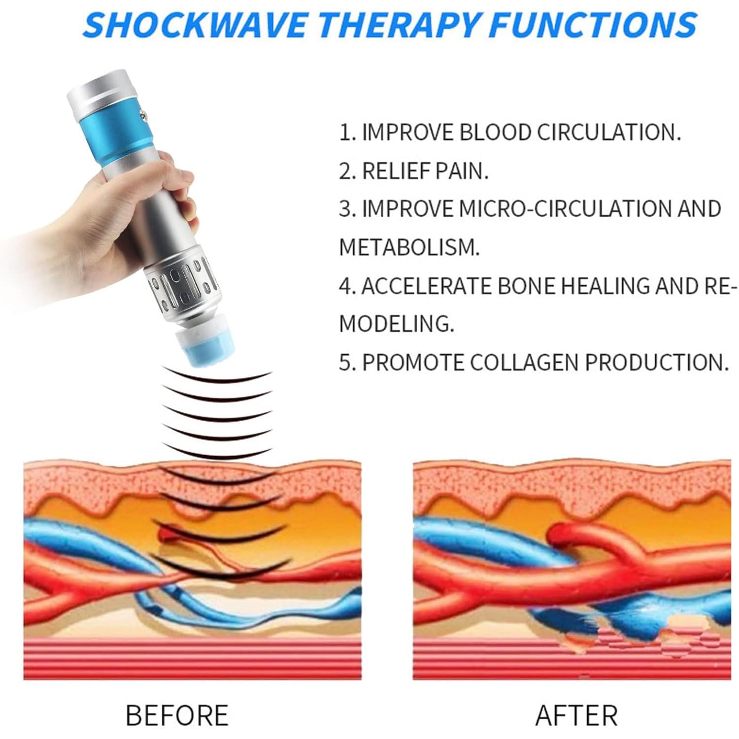 Dispositivo per Terapia Ad Onde D’Urto, Macchina ED 200W con 7 Teste Massaggianti, Regolazione a 27 Livelli, per Recupero Muscolare E Alleviamento del Dolore