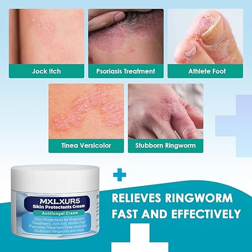 Miniatura 2 de MXLXURS Cremas protectoras para la piel, crema antifúngica de 3.53 onzas para el tratamiento de la tiña, picor fornido, pie de atleta, tratamiento