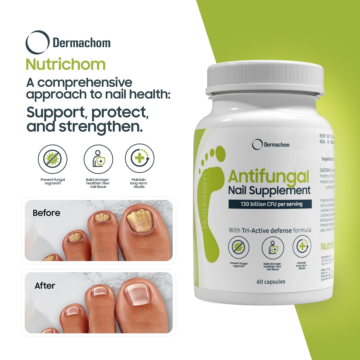Nutrichom Probiotic Fungal Nail Cleaner Supplement – Fights Fungus & Supports Healthy Nails with Vitamins & Natural Ingredients – 60 Capsules
