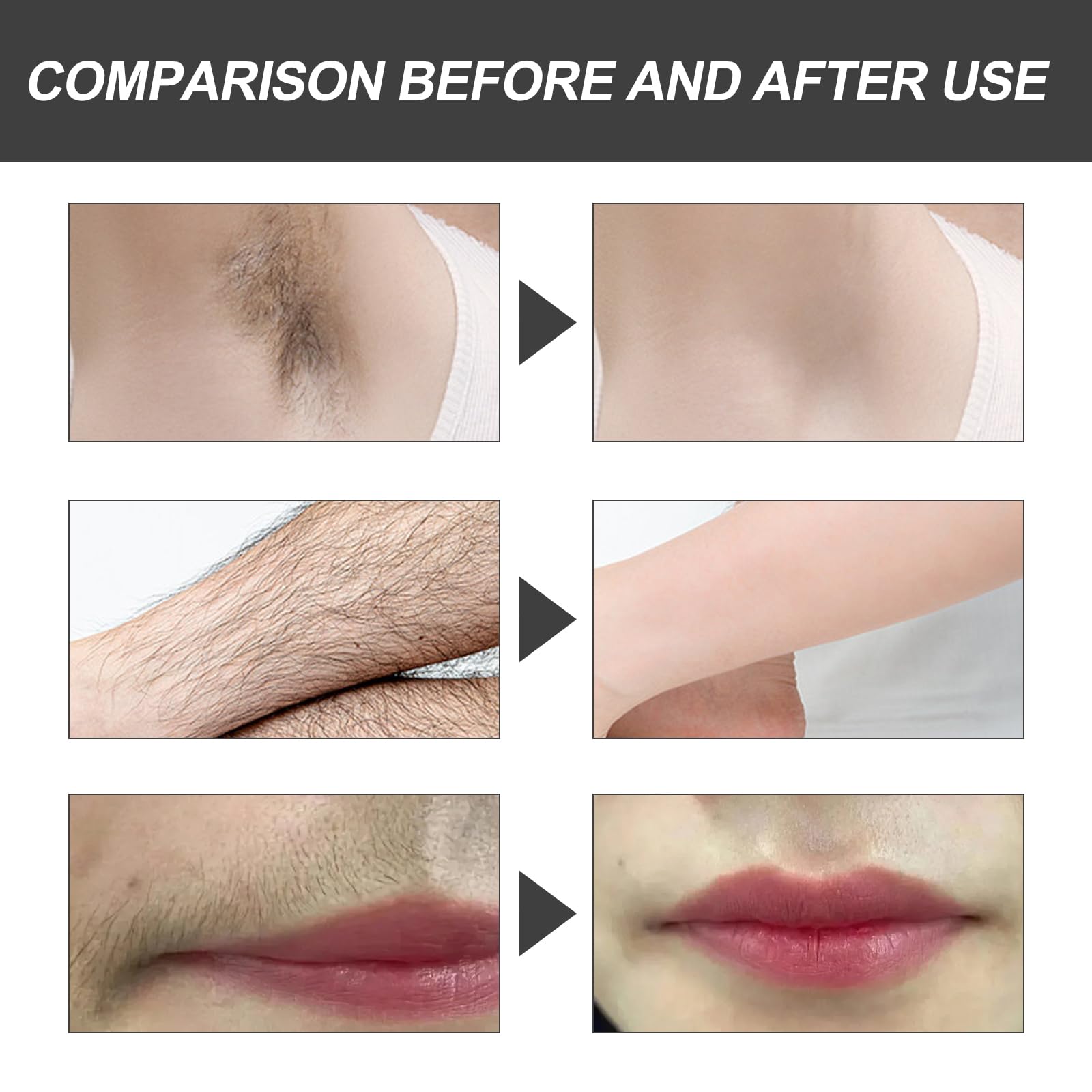 Perlas de Cera Depilatoriam, Cera Depilatoria en Perlas, Kit de Cera Avanzado Sin Bandas, Profesional Perlas de Cera Depilatoria Caliente, Cara, Cuerpo, Bikini, y Depilación Íntima Rosa