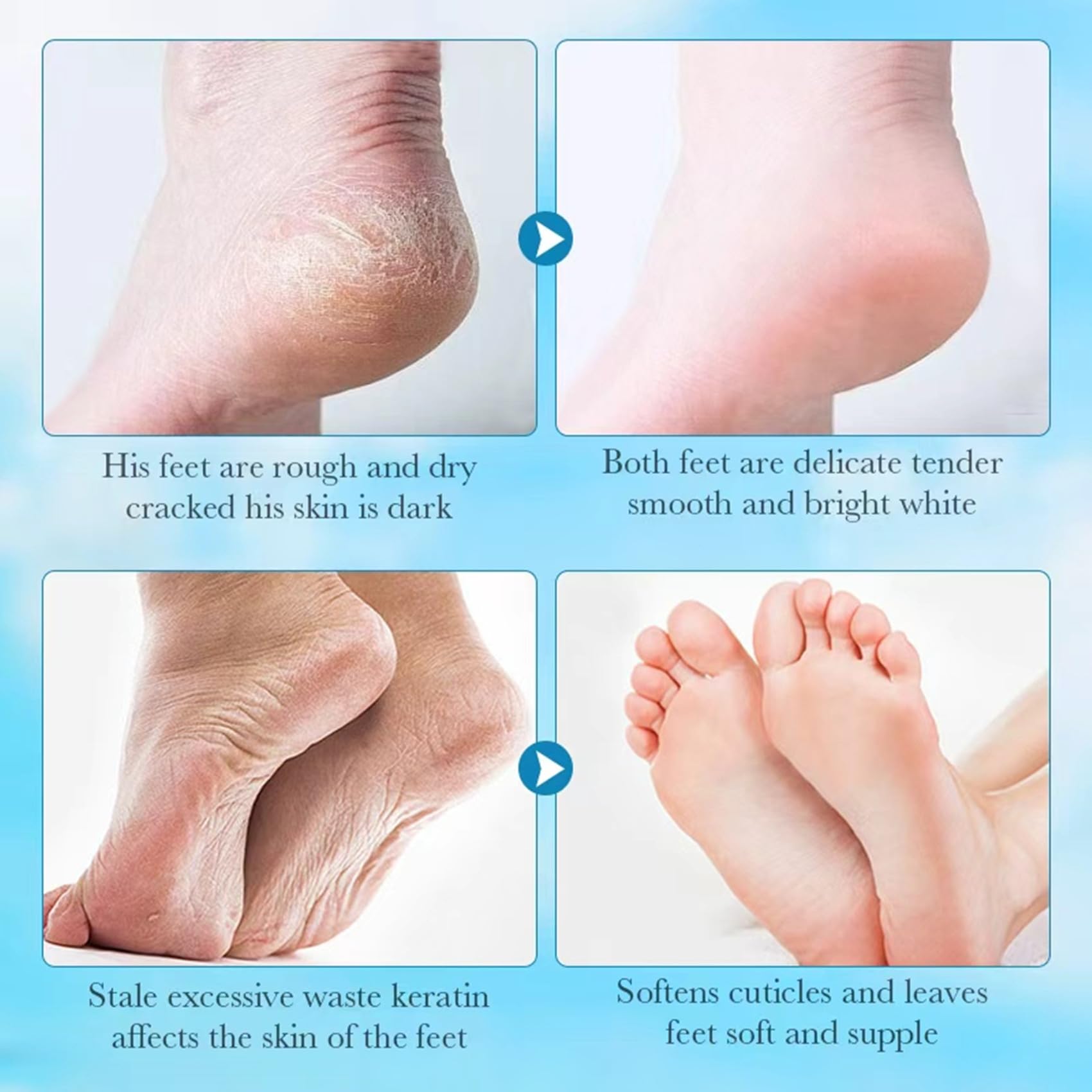 4 Paires Masque Pied Hydratant, Masque Pieds Exfoliant et Nourrissant, soin des pieds, pour Callosités, Crevasses et Pieds Secs et fendillés(2 paires Aloe vera + 2 paires Lavande)
