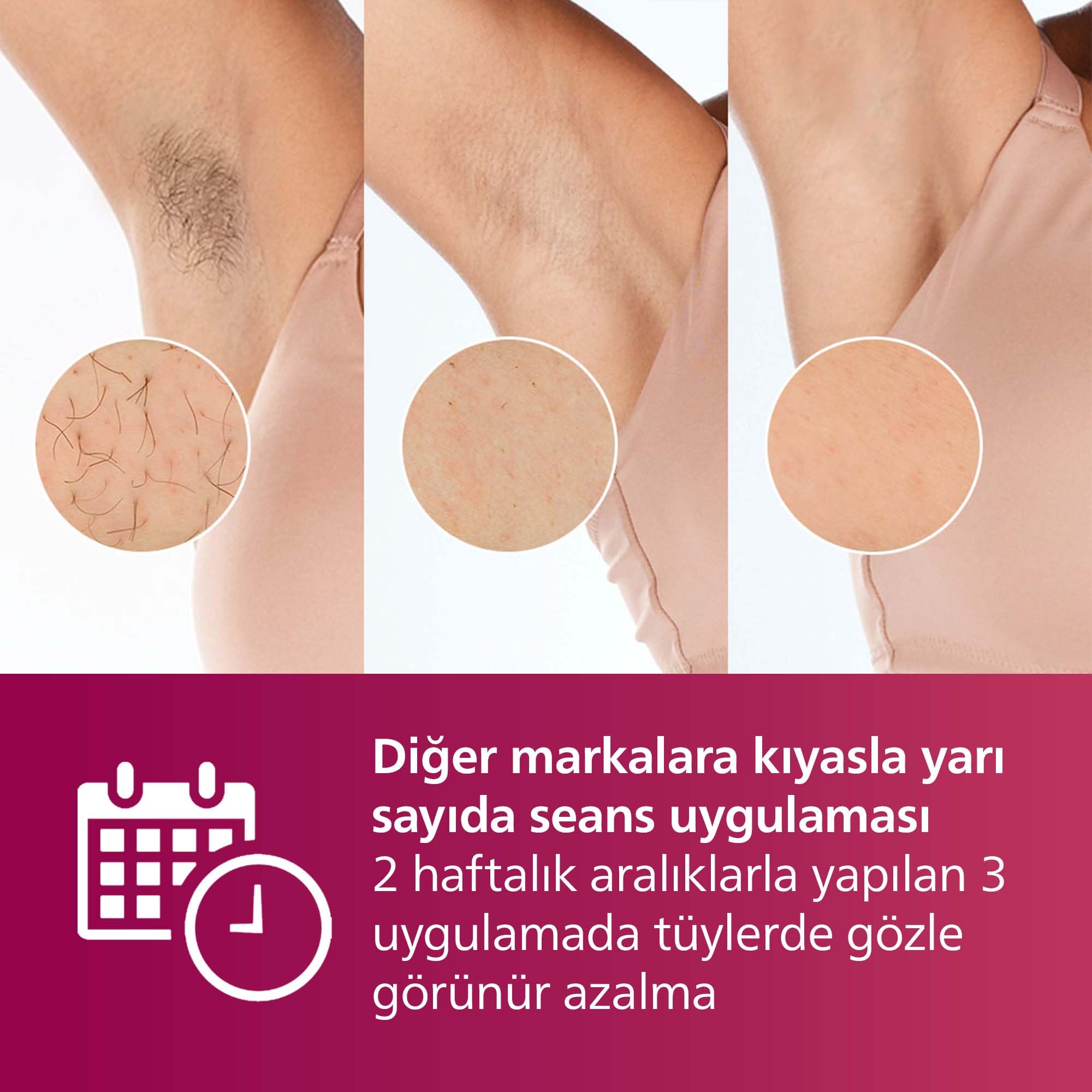 Philips Lumea IPL Tüy Alma Cihazı, Çantalı, Yüz Temizleme Cihazı Hediyeli, Yüz/Vücut/Hassas Bölge Kullanımı, Cilt Tonu Sensörü ile Güvenli Epilasyon BRI924/00