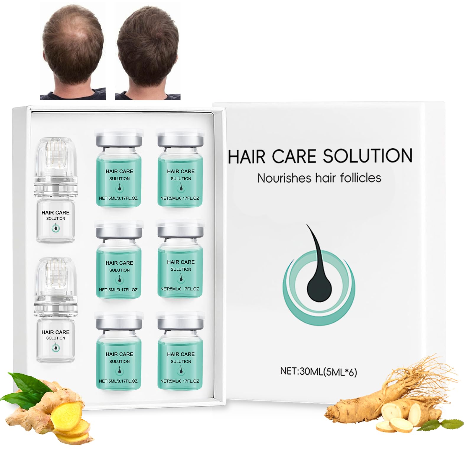 Alpha Infuse Hair, Alpha Infuse Hair, Microneedling Capelli, Alphainfuse Hair Regrowth System, Siero Crescita Capelli, Accelera la Crescita Dei Capelli, Li Rinforza e ne Nutre le Radici, (5 Ml*6)