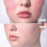 Vista 6 de BASE LABORATORIES Aerosol de ácido hipocloroso para rostro y piel 8oz Solución de reparación diaria de la piel facial para piel sensible