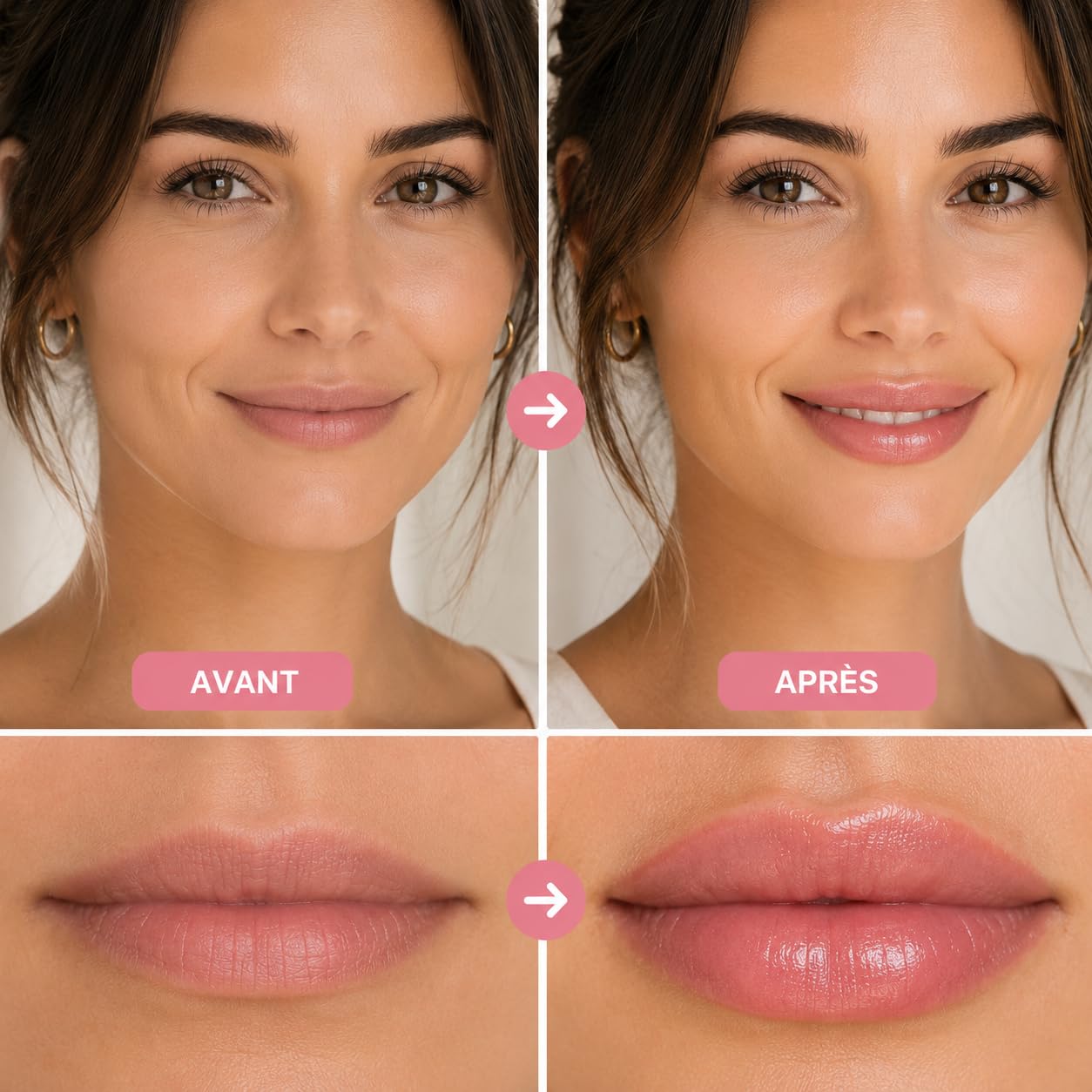 Lip Boost – Repulpeur Lèvres Microneedling – Dermaroller Lèvres 0,25 mm Réservoir – Sérum Acide Hyaluronique + 140 Aiguilles Titane – Lèvres Pulpeuses Sans Injection – Ebook Offert