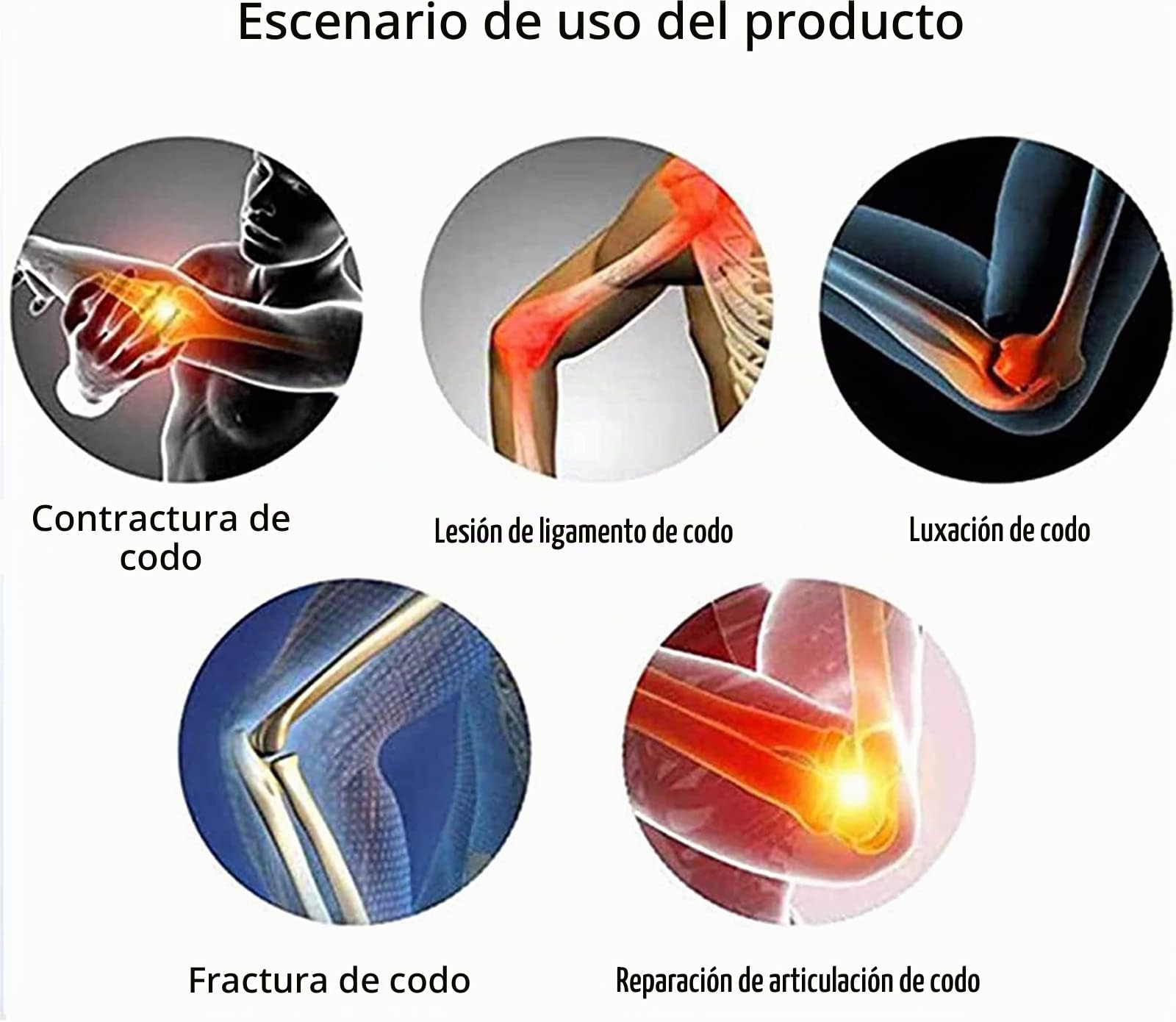 Codera articulada, férula de Brazo posoperatoria telescópica Ajustable, con órtesis de Brazo estabilizador de Cabestrillo, para dislocado y recuperación de Lesiones en el Brazo