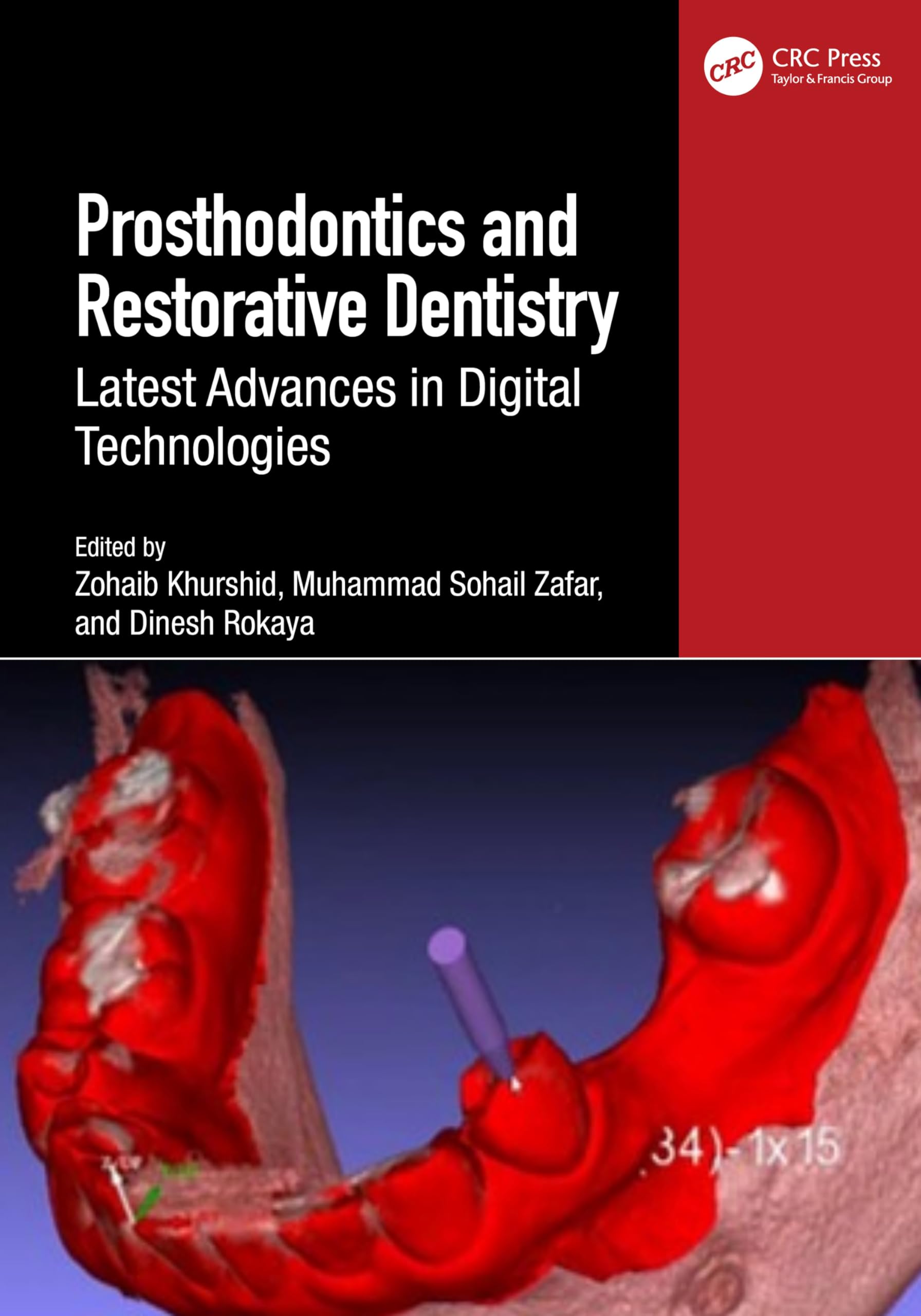 Prosthodontics and Restorative Dentistry: Latest Advances in Digital Technologies
