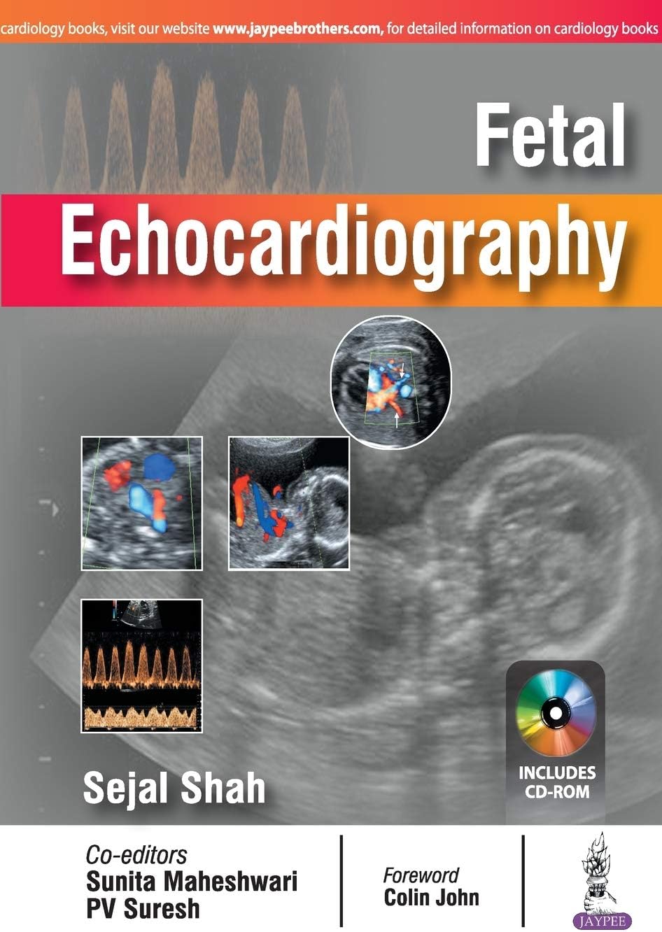Fetal Echocardiography Paperback – 1 January 2017