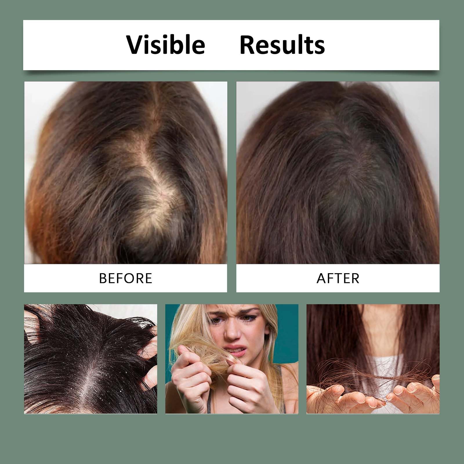 Olio di rosmarino per la crescita dei capelli, olio rinforzante per capelli del cuoio capelluto, rosmarino, cheveux ispessimento trattamento della crescita, leggero non grasso cheveux Huile, Haar Öl