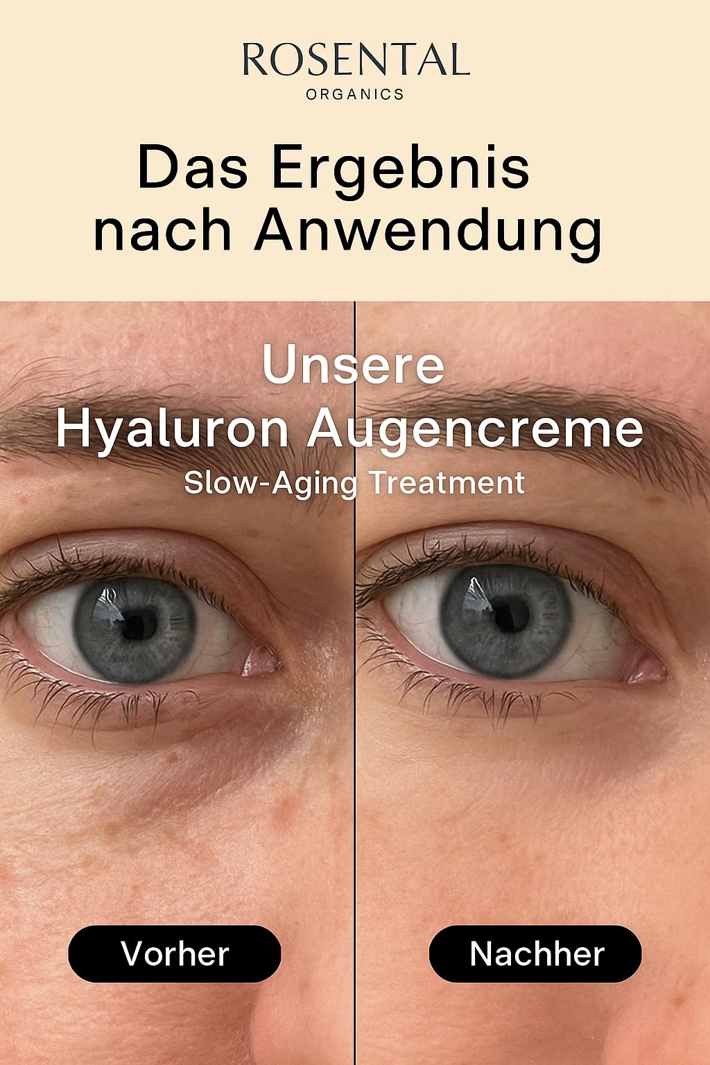 Rosental Organics Hyaluron Eye Balm (15 ml) – przeciwzmarszczkowy krem pod oczy – krem nawilżający z aloesem i olejkiem jojoba – pielęgnacja oczu – naturalny kosmetyk