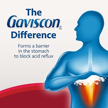 Gaviscon Extra Strength, 120 chewable tabs
