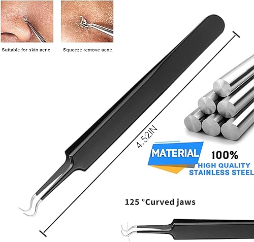 Miniatura 4 de Free Eagle Herramienta para eliminar puntos negros, extractor de comedones, kit de eliminación de acné, 4 piezas para reventar puntos blancos,