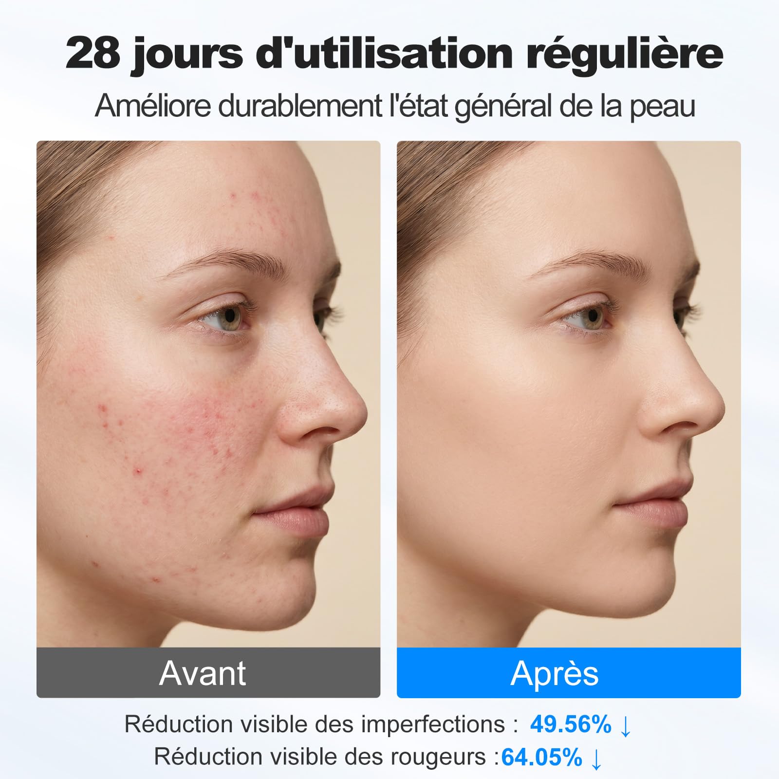 Masque LED Visage Cou 7 Couleurs 5 Luminosité Minuterie | Masque LED avec 7 couleurs, 5 niveaux de luminosité et minuterie, pour visage et cou, adapté à tous les types de peau