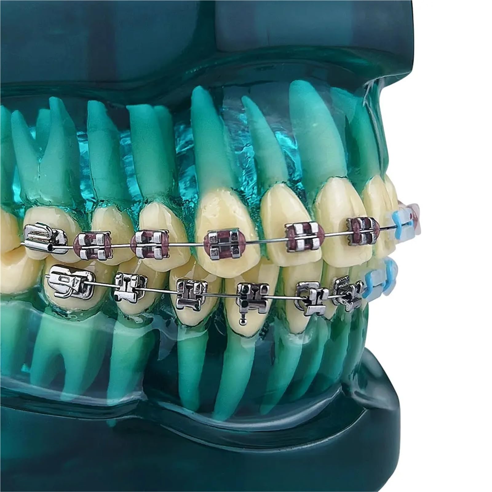 Modello ortodontico per la comunicazione del paziente, trattamento odontoiatrico demo con staffe metalliche autoliganti, ideale per cliniche e scopi educativi