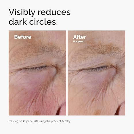The Ordinary Caffeine Solution 5% + EGCG, Depuffing Eye Serum for Dark Circles and Tired Eyes