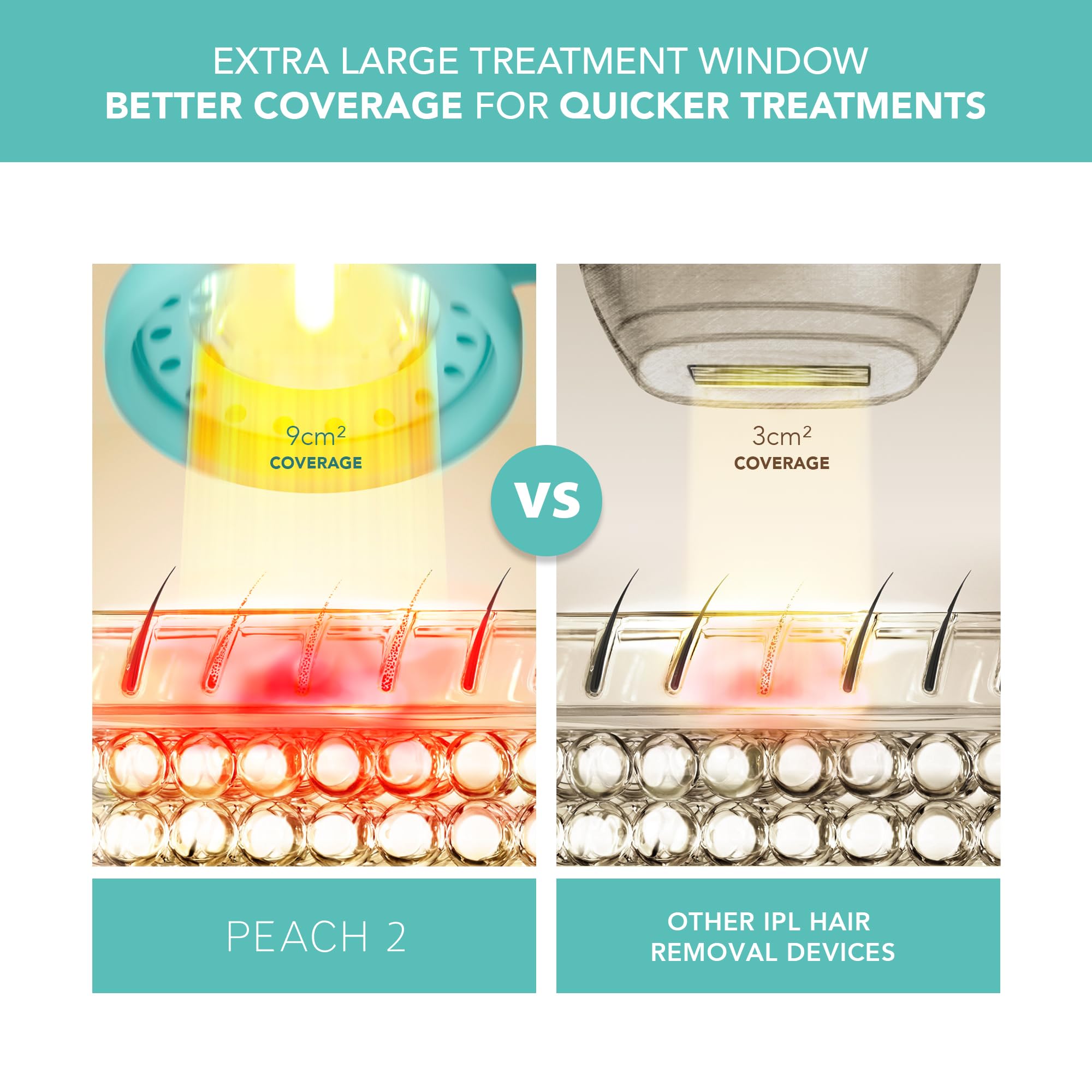 FOREO PEACH 2 IPL Hair Removal Device – Quick & Gentle Hair Reduction – For Full Body & Face – Skin Cooling System – Silicone Shield - Artic Blue