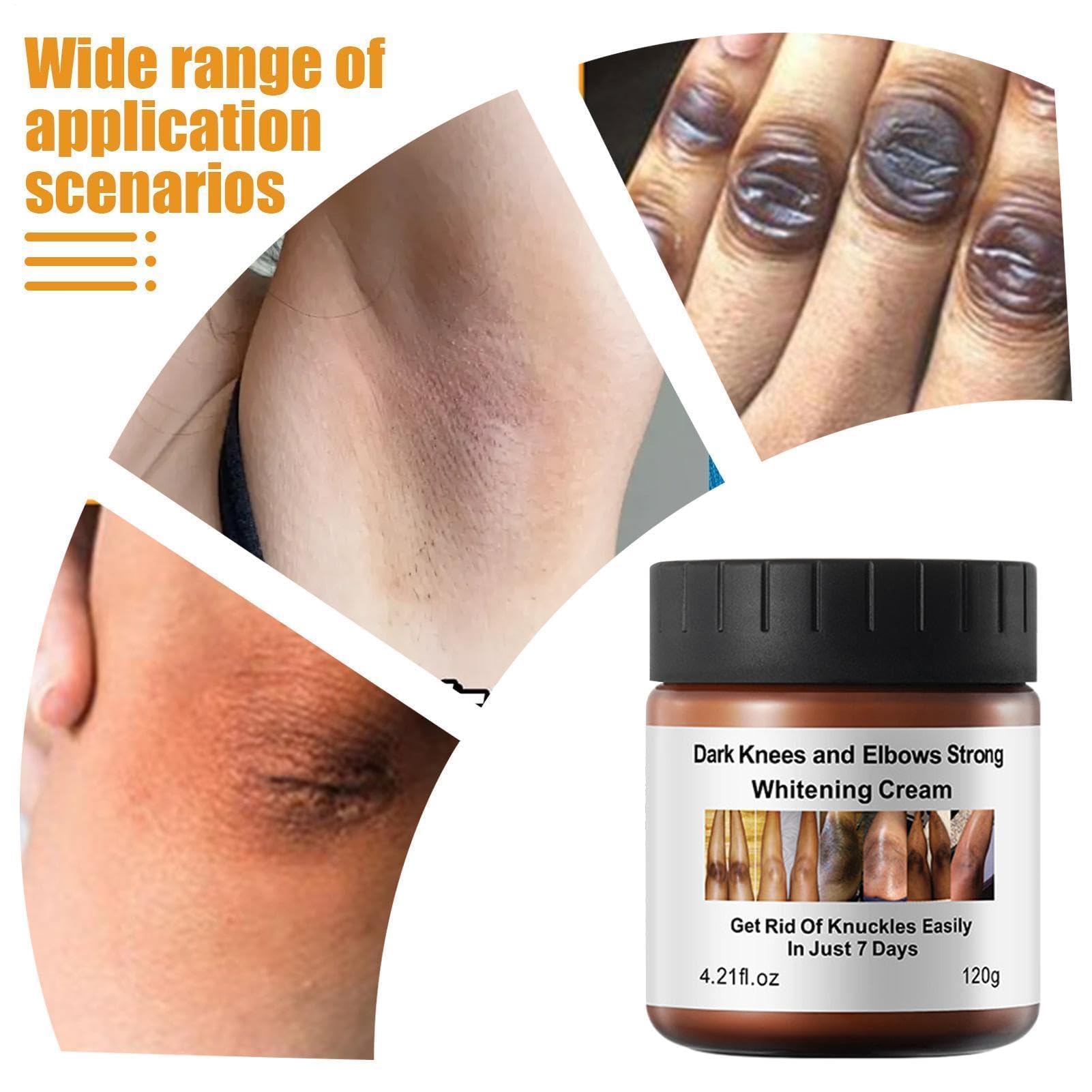Crema schiarente per ginocchia, siero schiarente per nocche scure; per ascelle, ginocchia, gomiti e interno coscia; adatto a tutti i tipi di pelle（3Pcs）
