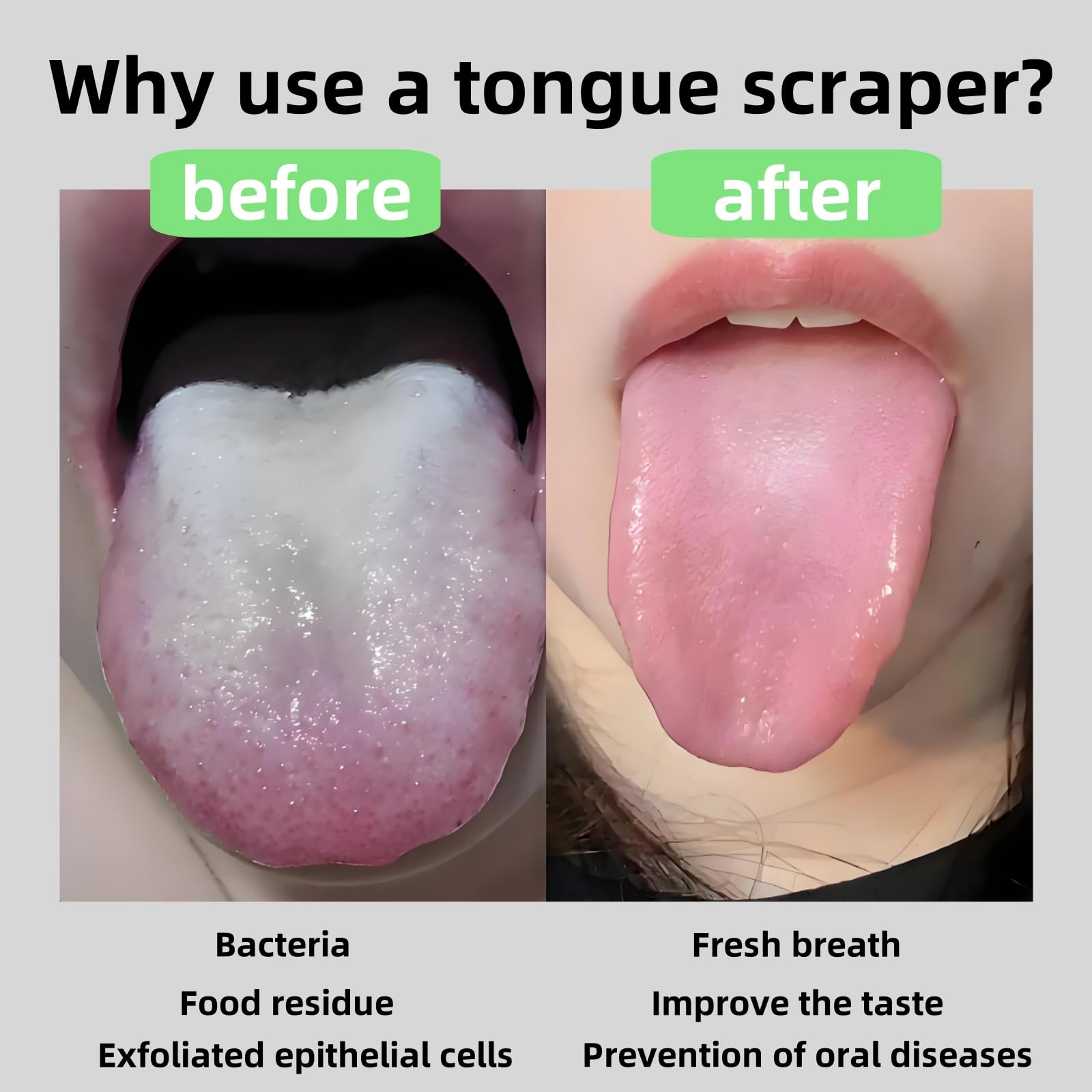 Rascador de lengua brillante de metal para adultos y niños, limpiador de lengua de acero inoxidable con diamante para cuidado e higiene bucal (blanco)