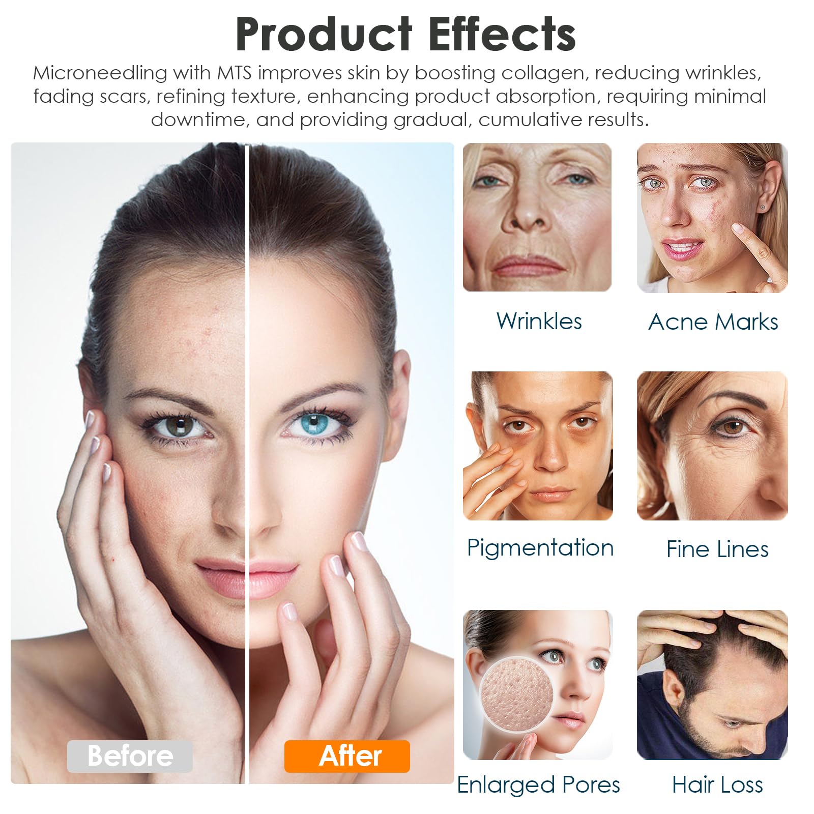 30Pcs Agujas de Microneedling de 12 Pin para Microneedling Dr.pen A7, Micropunción de Repuesto Desechables Originales, Microagujas Accesorios para el Cuidado de la Piel (12 Pin, 30Pcs)