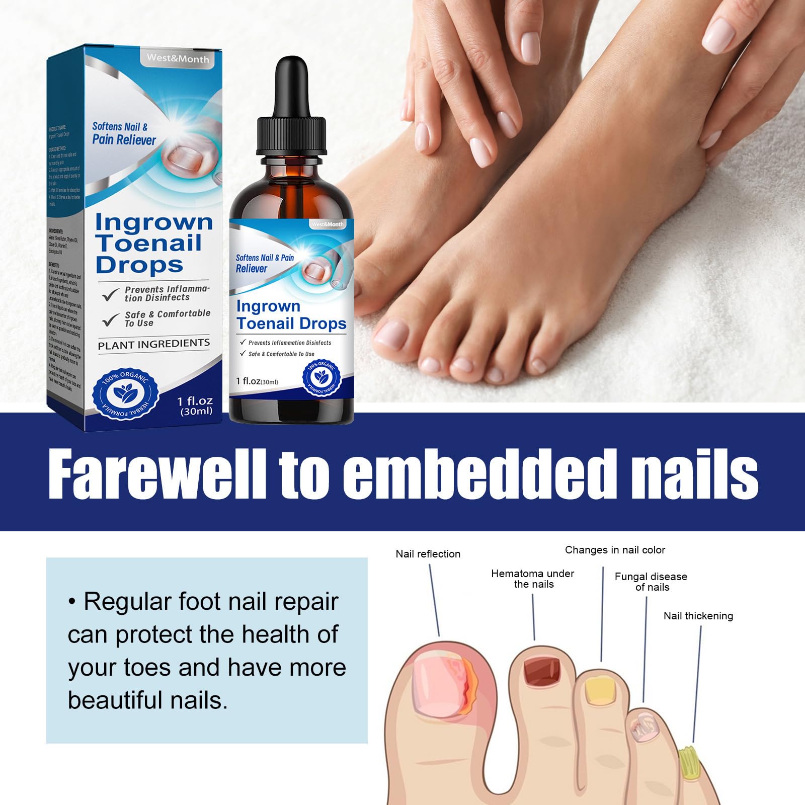 Ingrown Toenail Liquid - 30ML Ingrown Toenail Correction Drops - Nail Helper Ingrowth Toenail Oil - Trimming Toenail Softening Drops - Image 2