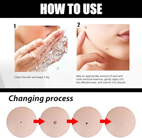 Miniatura 6 de Befada Removedor de marcas cutáneas para cara y cuerpo  Eliminador de verrugas de acción rápida con gotero preciso, objetivos para callos, verrugas